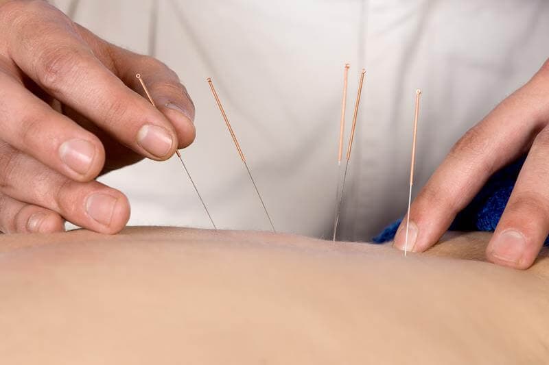 Traditional Chinese Medicine